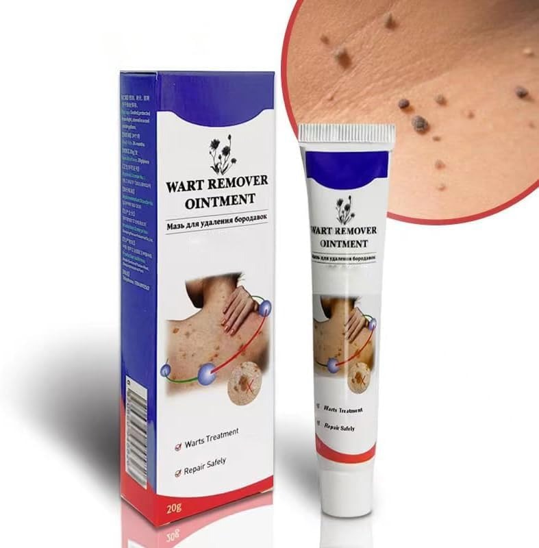 Warts Remover